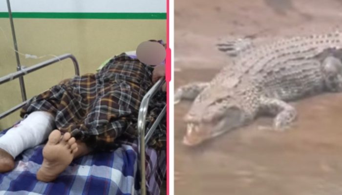 Diserang Buaya Saat Petik Daun Ubi, IRT di Luwu Alami Luka Serius